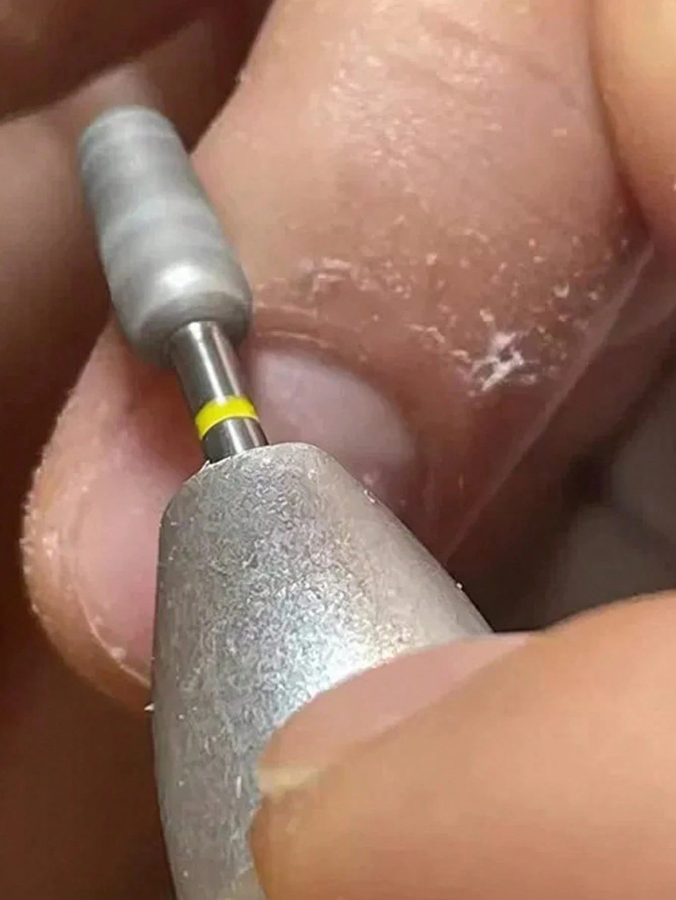1 Nail Drill Bit- A Nail Surface Preparation Tool For Removing Dead Skin, Cuticles, And Hangnails (Professional Nail Tool)| Nail Supplies, Home Salon